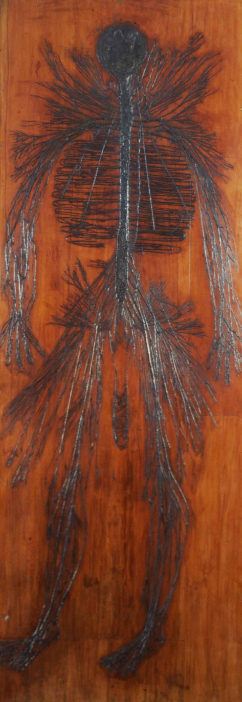 Table with the preserved dissected venous or nervous system of a human male. The dissection appears as black lines in the shape of a human body attached to a wooden board.