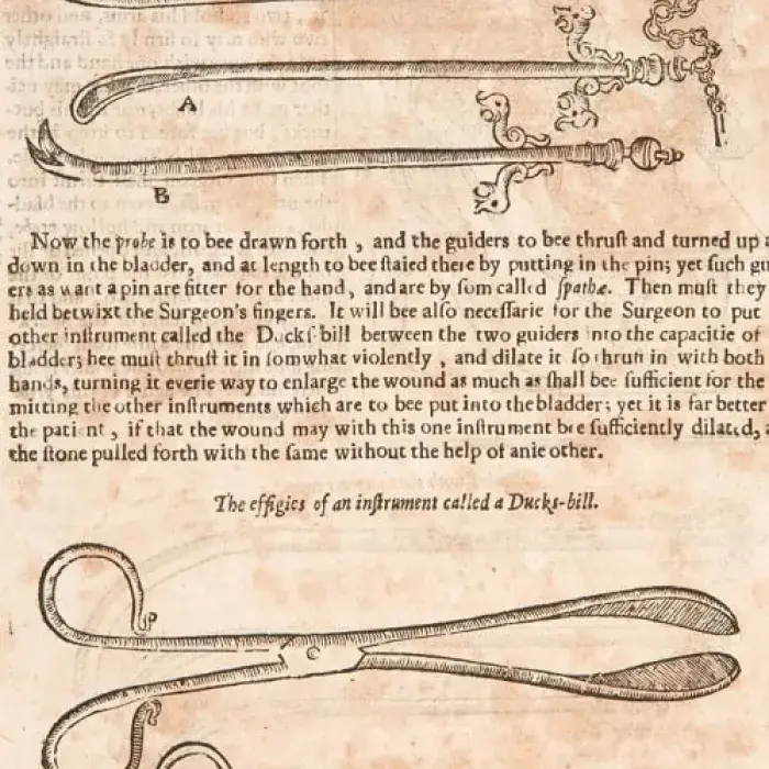 Illustration of lithotomy forcepts