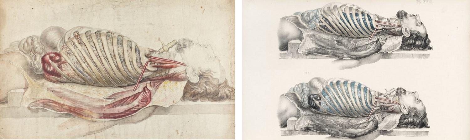 Colour illustration of a dissected male torso and head laying on his back and two colour illustrations of a dissected male torsos and head laying on his back.